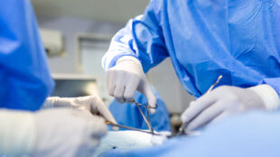 Kirurger med instrument under en operation.